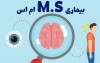 شایع ترین نشانه های بیماری ام اس + روش های کنترل و درمان